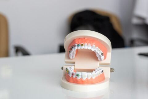 Teeth Alignment