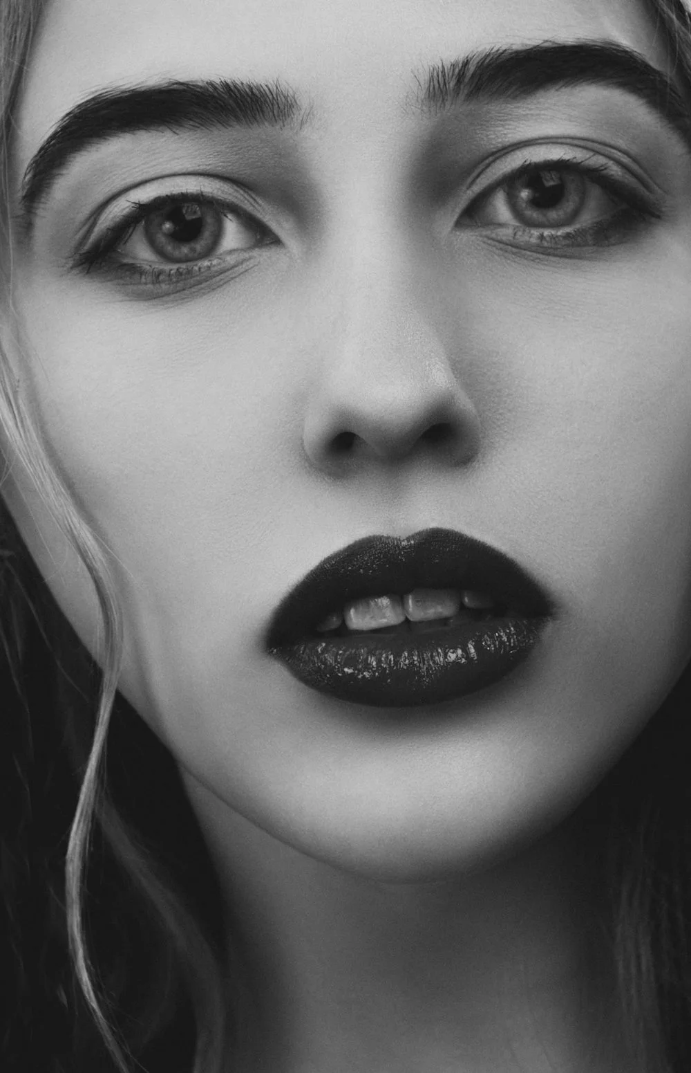 Lip Fillers